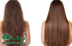 درباره این مقاله بیشتر بخوانید چطور موهای آسیب‌دیده را زنده کنیم؟